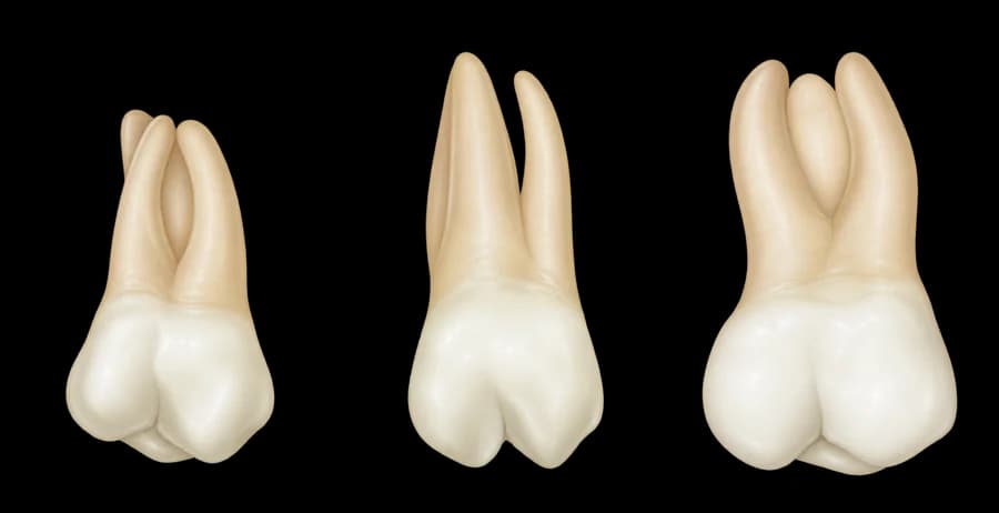 Tre overkjevemolarer i samme illustrasjonsstil som tennene i periodontogrammet
